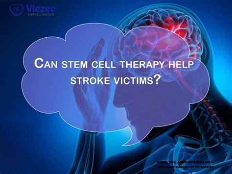 Where can i get stem cell treatment for stroke