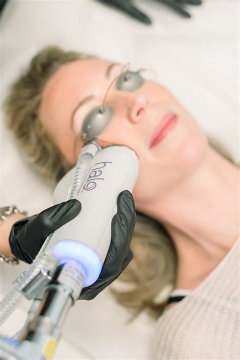 How much is halo laser treatment