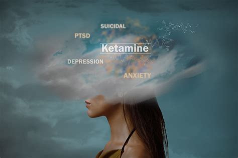 Why is ketamine treatment so expensive