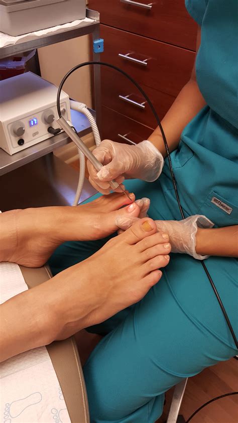 How much is toenail laser treatment