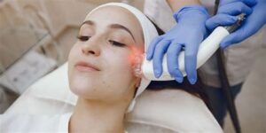 What is the best laser treatment for sun damaged skin
