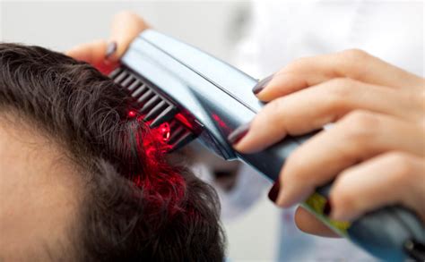 What hair type responds best to laser hair treatment